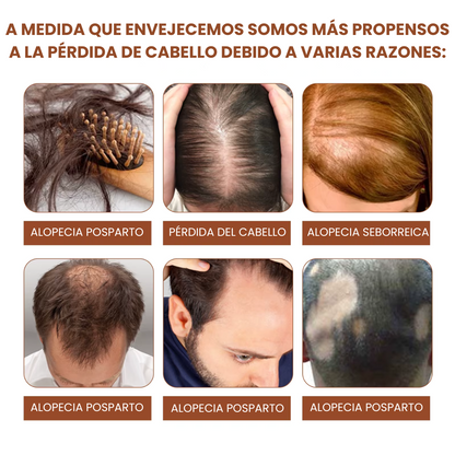 Mascarilla Capilar Postparto: Frena la caída y recupera volumen en 2 semanas.